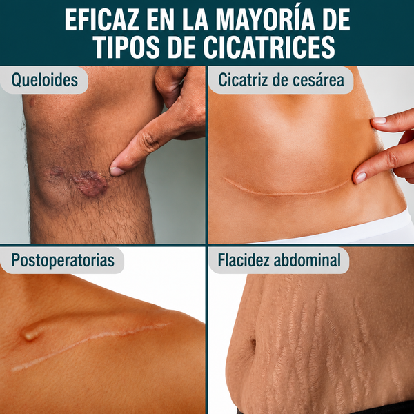 Cinta Silicona Reparadora